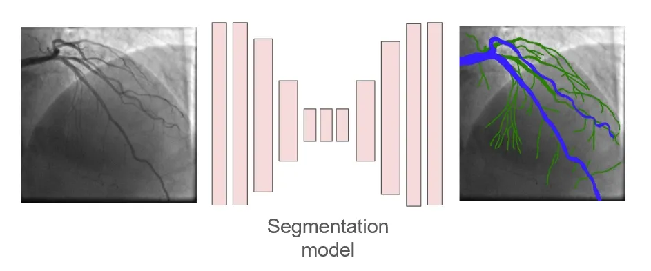 Image Segmentation
